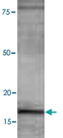 PAB0736 - LC3B