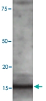 PAB0736 - LC3B