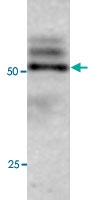PAB0737 - APG4C / ATG4C