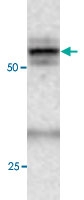 PAB0737 - APG4C / ATG4C