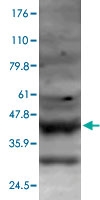 PAB0739 - APG16L / ATG16L1