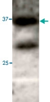 PAB0740 - APG3 / ATG3