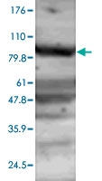 PAB0741 - APG9L1 / ATG9A