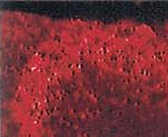 PAB0743 - BDNF