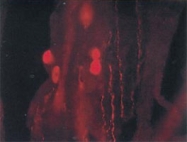 PAB0743 - BDNF