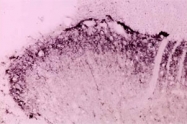 PAB0745 - BDNF