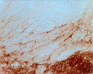 PAB0754 - Beta-Synuclein / SCNB