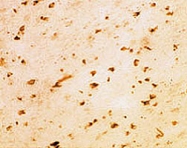 PAB0767 - Alpha-Synuclein / SNCA