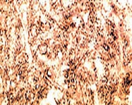 PAB0769 - Beta-Synuclein / SCNB