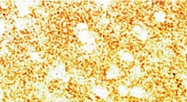 PAB0770 - Alpha-Synuclein / SNCA