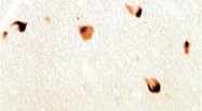 PAB0770 - Alpha-Synuclein / SNCA