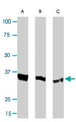 PAB0815 - CDK2