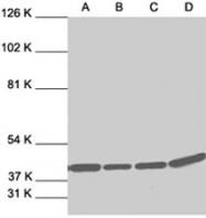 PAB0825 - ERK2