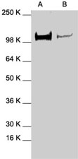 PAB0831 - STAT2