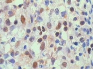 PAB0836 - RELA / NF-kB p65