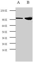PAB0848 - Retinoblastoma-associated protein / RB1