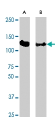 PAB0864 - CBL / RNF55