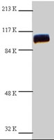 PAB0872 - Catenin beta-1