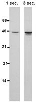 PAB0882 - HSPBP1