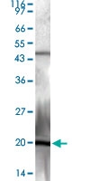PAB0926 - Respiratory Syncytial Virus / RSV