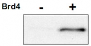 PAB10000 - CDK9