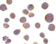 PAB10003 - CD261 / TRAILR1