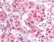 PAB10004 - E2F1