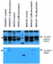 PAB10004 - E2F1