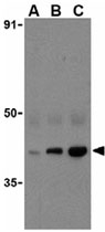 PAB10005 - ECSIT