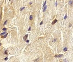 PAB10005 - ECSIT