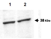 PAB10008 - EIF3F / EIF3S5
