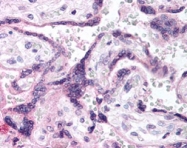 PAB10009 - EGFR / ERBB1