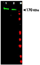 PAB10010 - EGFR / ERBB1