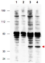 PAB10011 - FANCF