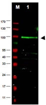 PAB10012 - FBXO9