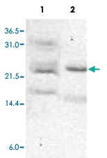 PAB10019 - APC10 / ANAPC10