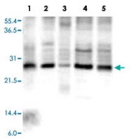 PAB10019 - APC10 / ANAPC10