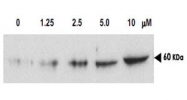PAB10034 - CHK2