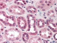 PAB10039 - Cullin-5