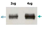 PAB10043 - DNMT3L