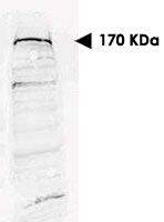 PAB10044 - SETDB1