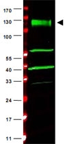PAB10045 - FANCA