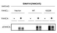 PAB10045 - FANCA