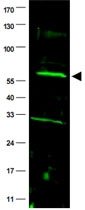 PAB10046 - FANCC