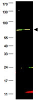 PAB10048 - XRCC9 / FANCG