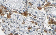 PAB10048 - XRCC9 / FANCG