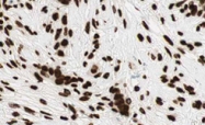 PAB10051 - GLI2