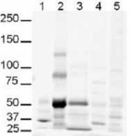 PAB10052 - GLI3