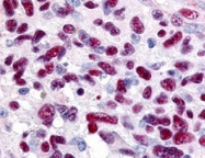 PAB10052 - GLI3
