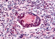 PAB10055 - GSK3 beta